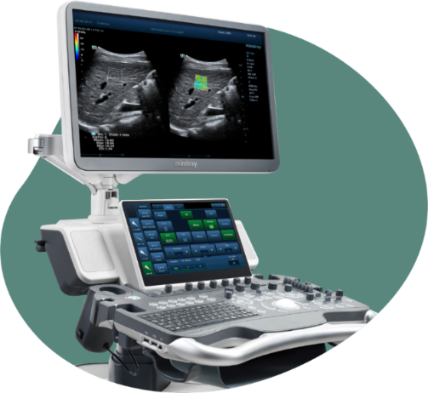 Узи органов малого таза