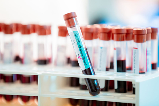 Анализы на антитела