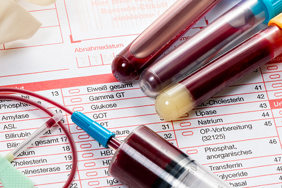 Биохимический анализ крови